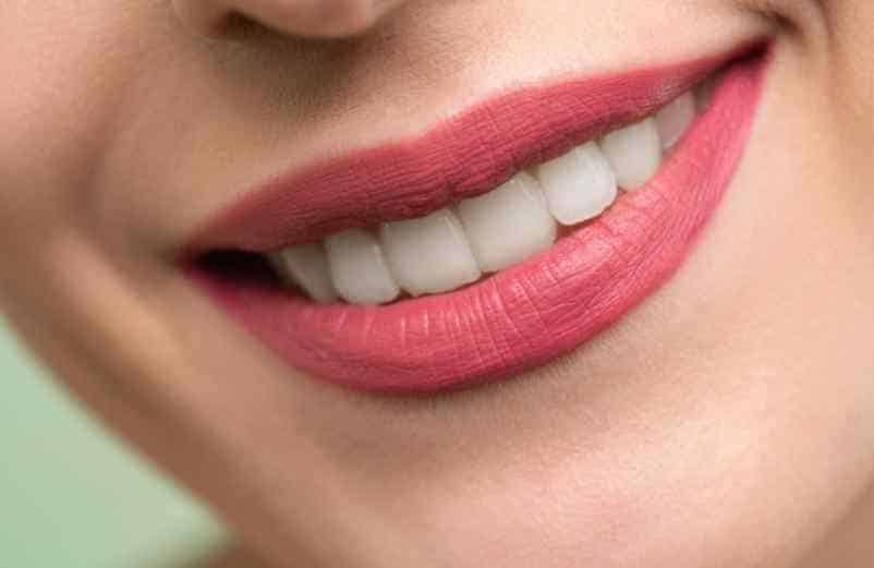 Comment blanchir les dents naturellement sans les abîmer ? Kiné-Service
