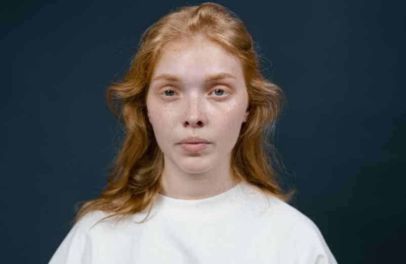 Manque de fer : symptômes dans les yeux, le visage et signes d’anémie Kiné-Service